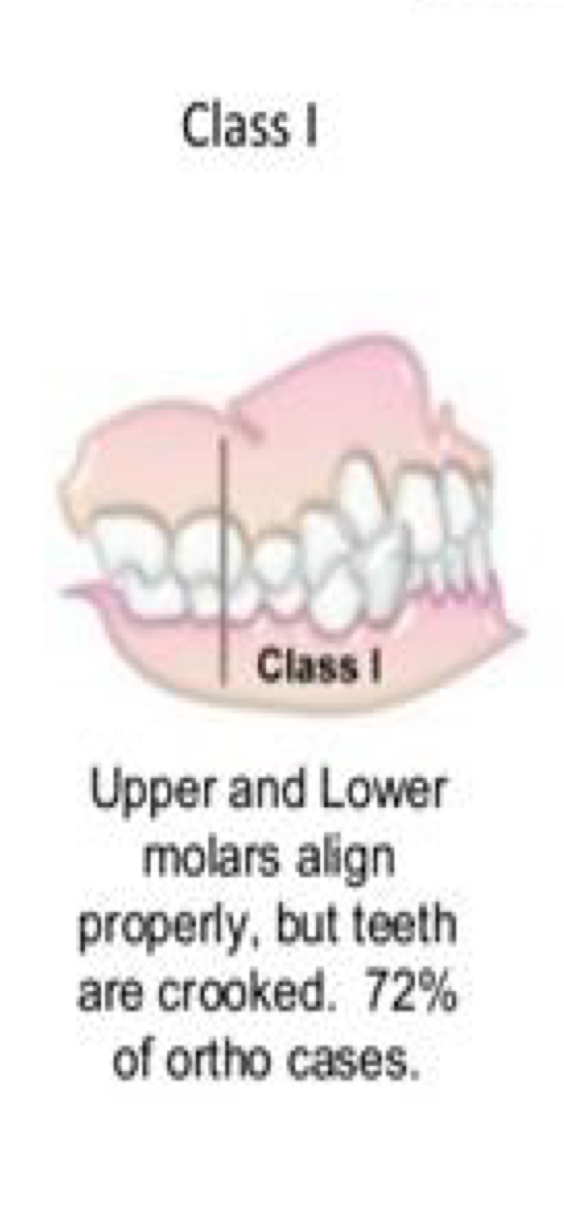 <p>Normal molar relationship </p>