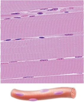 <p>Identify this type of muscle</p>
