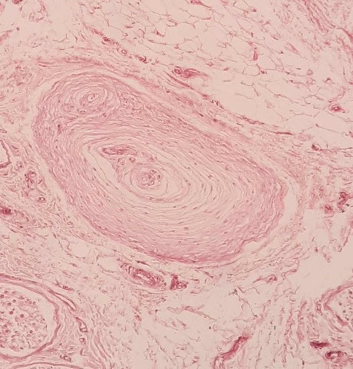 <p>General: Somatic:</p><p>Tactile aka Lamellated Corpuscle; found in the dermis, hypodermis and other body tissues; its capsule resembles</p><p>an onion and detects high-frequency vibration</p>