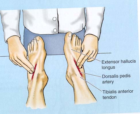 <p>artery supplying the foot, lateral to the large tendon of the big toe</p>