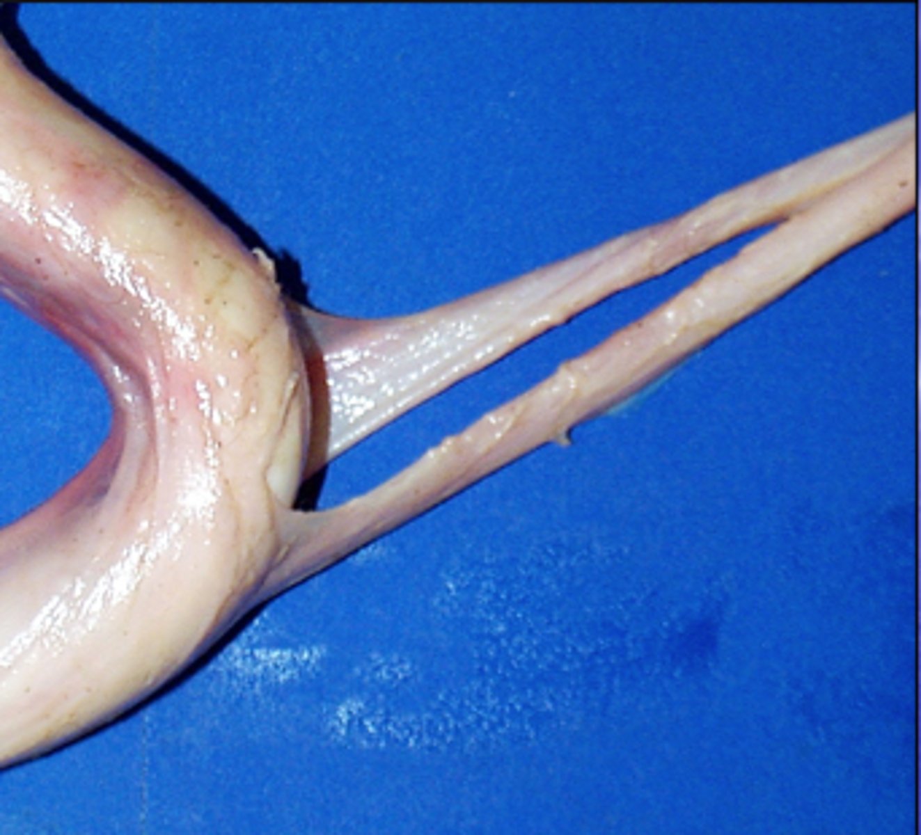 <p>What muscle retracts the penis and is shown in the image?</p>