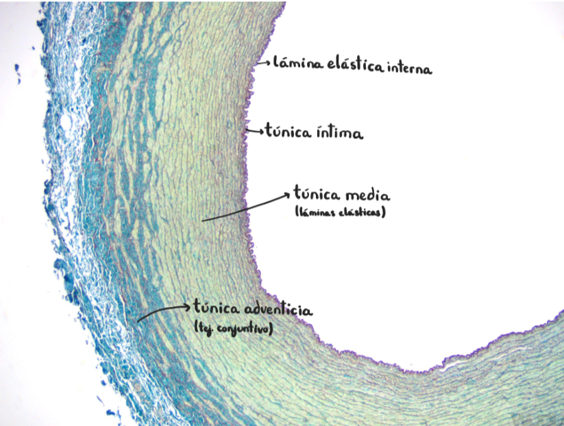 <p>AORTA (arteria elástica)</p><ul><li><p>túnica intima - teñida de rojo (orceína)</p></li><li><p>túnica media - teñida de verde (fibras elásticas)</p></li><li><p>túnica adventicia - teñida de azul (puede parecer que hay 2)</p></li></ul><p></p>