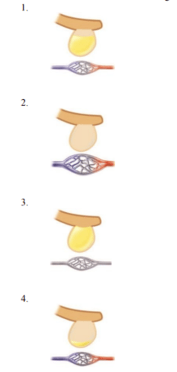 <p>35) The nurse is explaining the process of how a newborn adapts to breathing after delivery. In which order should the nurse review the following diagrams?</p>