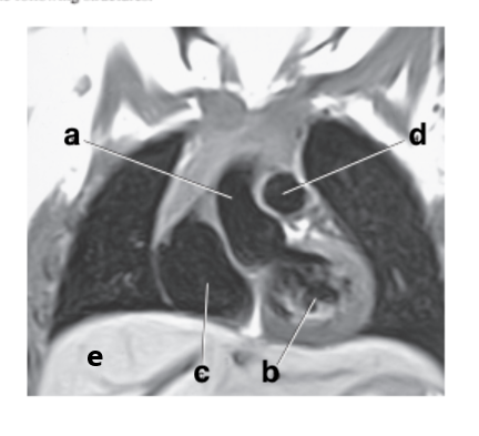 <p>What is letter b?</p>