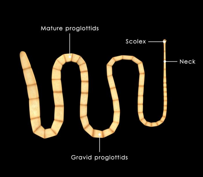 <p>Tapeworms</p>