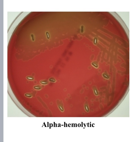 <p>alpha hemolysis </p>