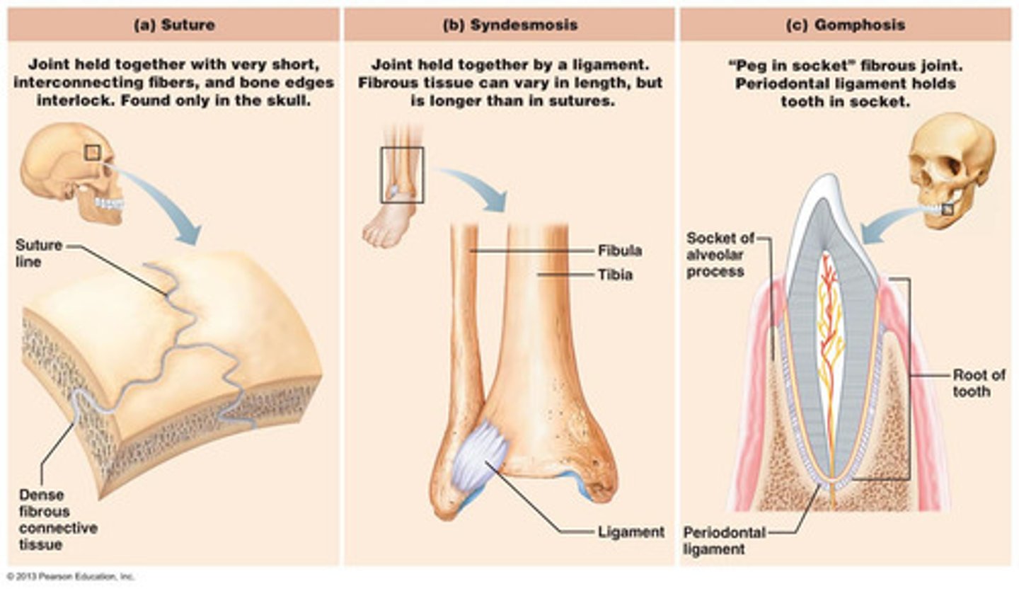 <p>consists of inflexible layers of dense connective tissue, holds the bones tightly together</p><p>1) suture</p><p>2) gomphosis</p><p>3) syndesmosis</p>