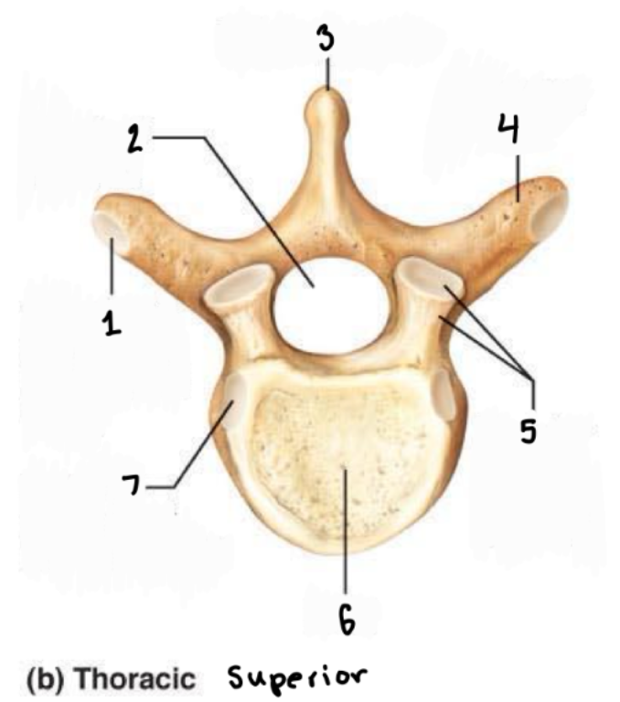 <p>What is #6 in the superior view of a thoracic vertebrae?</p>