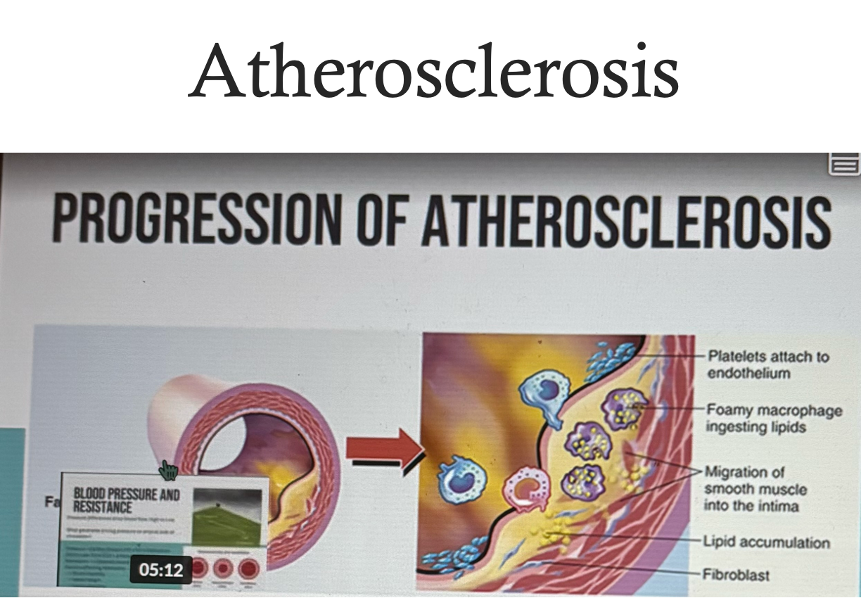 <p>Creation of <strong>Atherosclerosis</strong></p>