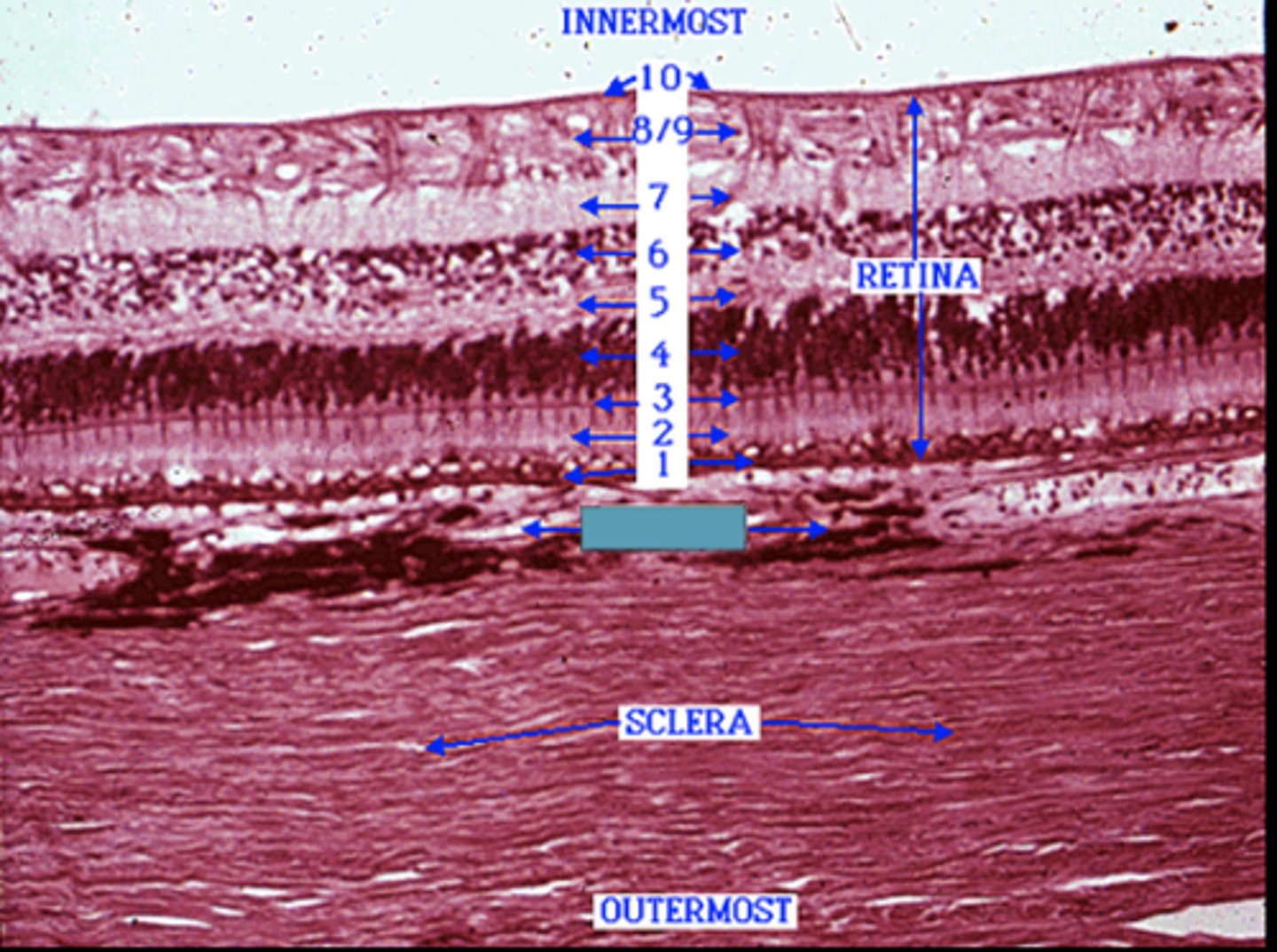 <p>Identify the layer (blue box)</p>