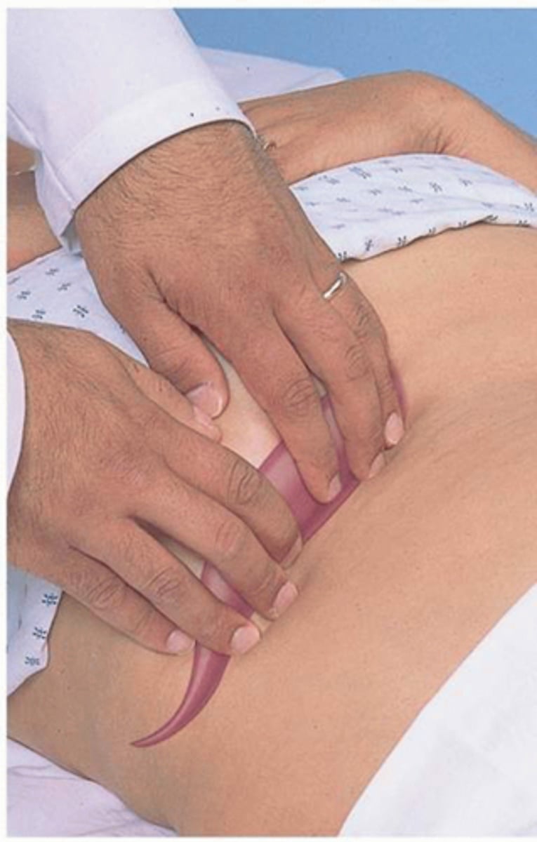 <p>"hooking technique"</p><p>- place both hands side to side, on the right abdomen below the border of liver dullness</p><p>- press in with the fingers and go up toward the costal margin. Ask the patient to take a deep breath. The liver edge should be palpable under the finger pads of both hands</p>