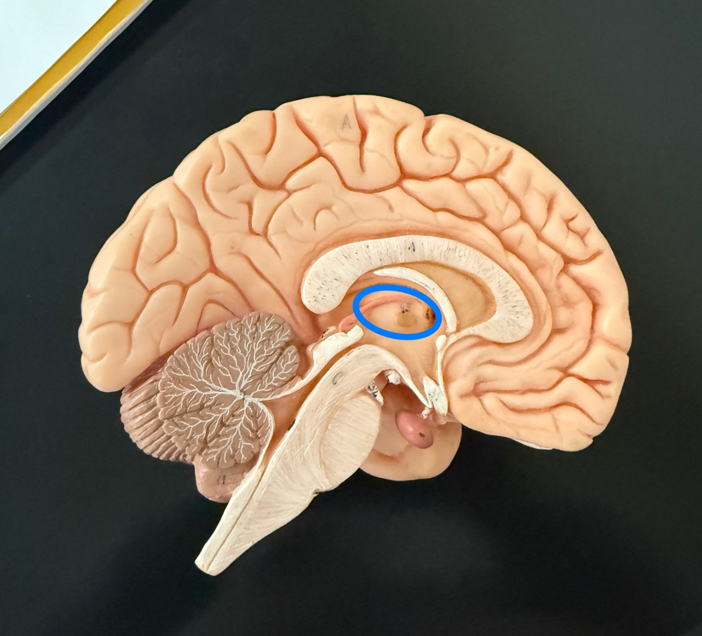 <p>What is outlined in blue on the brain model?</p>