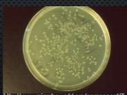 <p>original culture is serially diluted then the final dilution is spread on the surface of the plate. surface colonies grow</p>