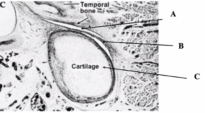 <p>where does structure A come from </p>