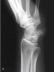 <p>What projection, position, and anatomy is this?</p>