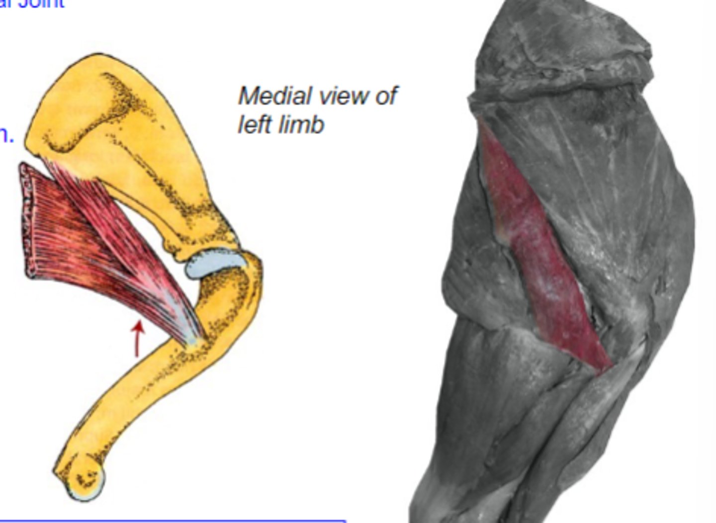 <p>Insertion of teres major:</p>