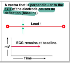 <p>electrical activity is moving perpendicular to the axis of the electrodes </p>