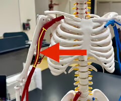 <p>Name the blood vessel.</p>