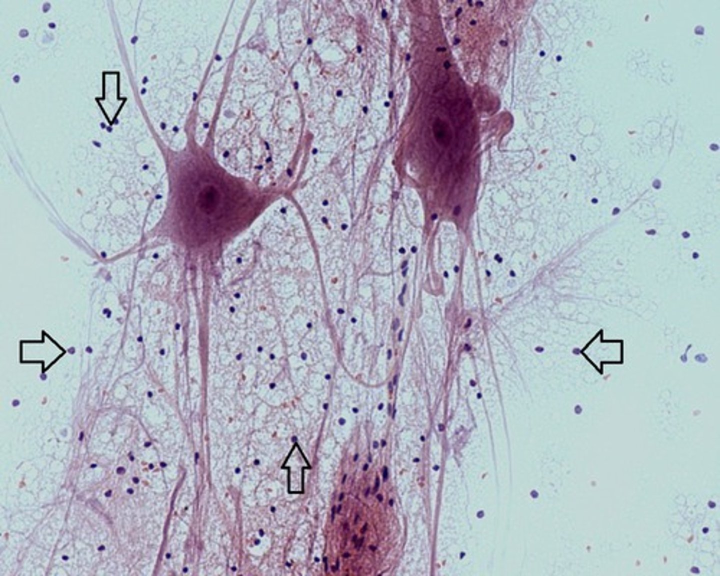 <p>what cell is this? (arrow)</p>