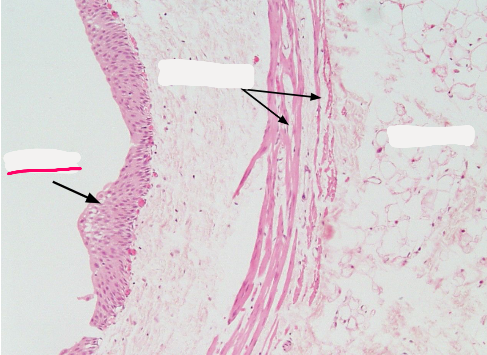 <ol><li><p><strong>Mucosa</strong></p></li></ol><p></p>