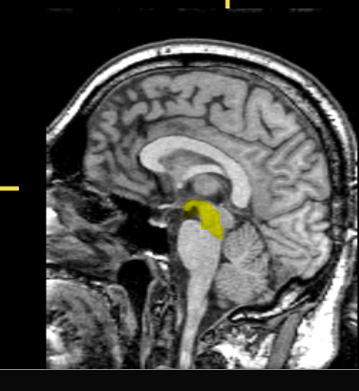 <p>What part of the brain is highlighted?</p>