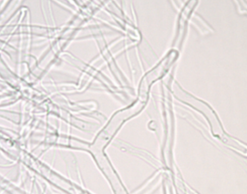 <ul><li><p>y-branching</p></li><li><p>No cross walls</p></li></ul><p></p>