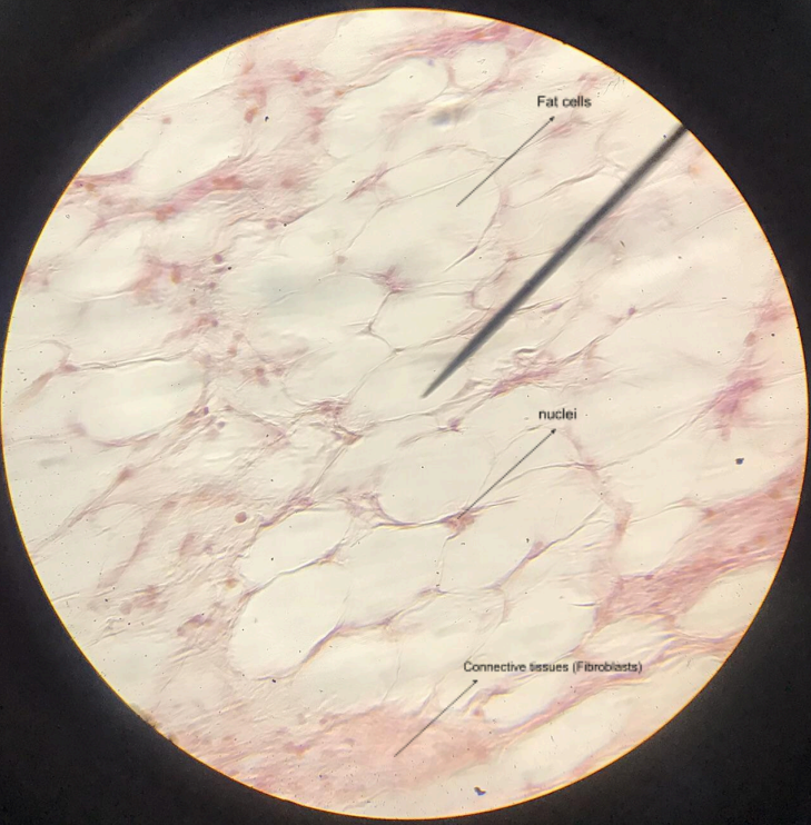<p>human skin; resemble signet rings; abundant in the subcutaneous layer (hypodermis) beneath the dermis; nuclei are located at the basal side of the cells</p>