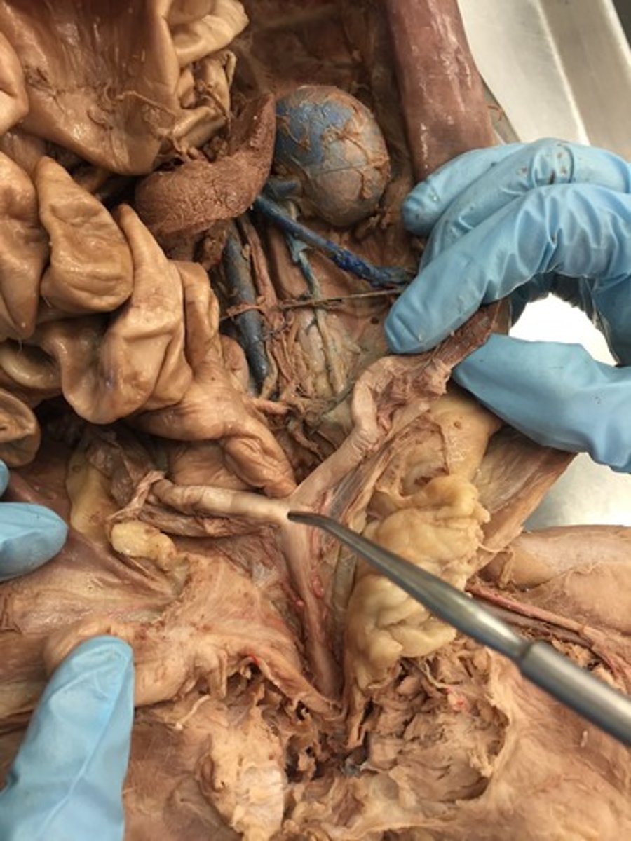 <p>between bladder and rectum</p>