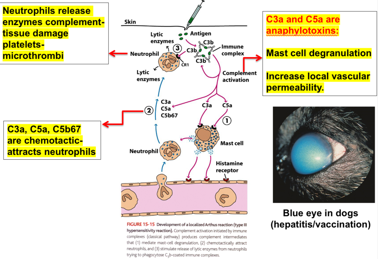 <p><span><span>Injection of an antigen intradermally or subcutaneously into an animal that has high levels of circulating antibody specific for that antigen leads to the formation of immune complexes, and they mediate Arthus reaction within 4-8 hrs.</span></span></p><p><span><span>Neutrophils adhere to the vascular endothelium and then migrate into the tissues at the site of immune complex deposition, leading to vascular damage (edema, erythema).</span></span></p><p></p><p><span><span>Examples:</span></span></p><p><span><span>1. Insect bites: can cause Type I reactions initially followed by Type III reactions.</span></span></p><p><span><span>2. Farmer’s lung disease: results from inhalation of thermophilic actinomycetes from moldy hay.</span></span></p><p><span><span>3. Pigeon fancier’s disease: due to inhalation of a serum protein in dust derived from dried pigeon feces. Both cause intrapulmonary Arthus-type reactions (local).</span></span></p>