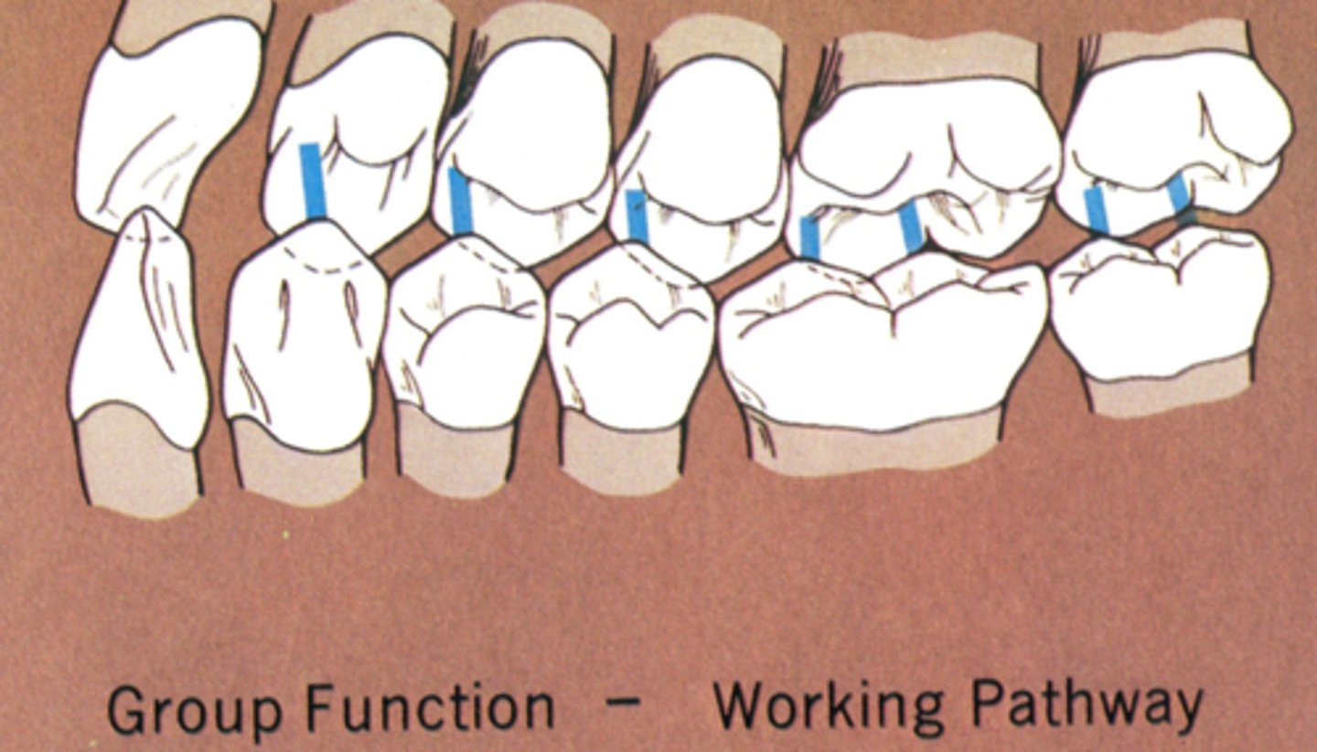 <p>- maxillary inclines = distal</p><p>- mandibular inclines = mesial</p>