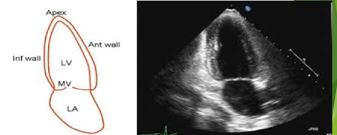 <p>What leaflet is on the right→?</p>