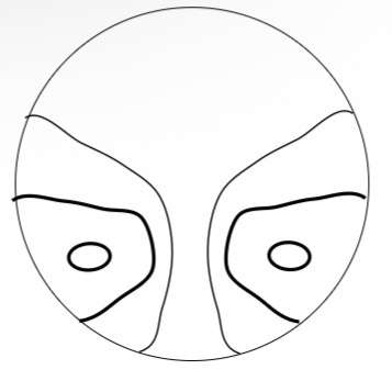 <p>Pt has to move their head more to get to maximum near Rx</p>