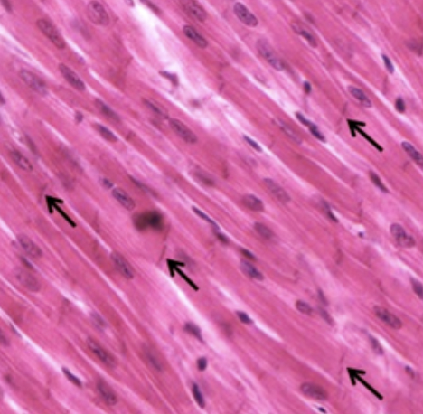 <p>--found in and makes up the heart <span data-name="anatomical_heart" data-type="emoji">🫀</span></p><p>-less striated than skeletal</p><p>-function →<strong> </strong><span><strong><span>generate rhythmic, involuntary contractions</span></strong><span> that </span><strong><span>pump blood throughout the body</span></strong><span>, delivering </span><strong><span>oxygen</span></strong><span> & nutrients & </span><strong><span>removing waste</span></strong></span></p>