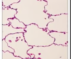 <p>single layer of flattened cells</p><ul><li><p>allows easy passage of materials by <strong>diffusion and filtration</strong>; secretes lubricating substances</p></li><li><p>located in <strong>kidney</strong>, glomeruli, air sacs of lungs, lining of heart, <strong>capillaries</strong>, and lymphatic vessels</p></li></ul><p></p>