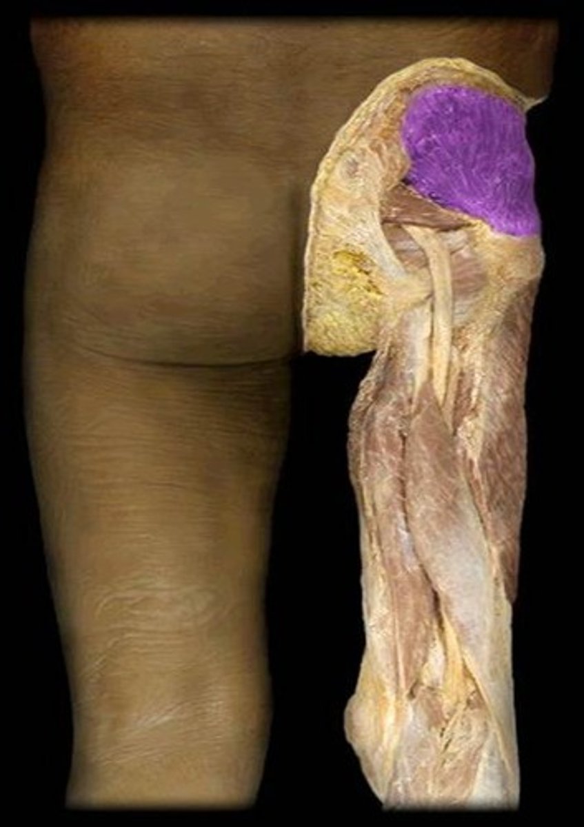 <p>What is the name of this muscle, highlighted in purple?</p>