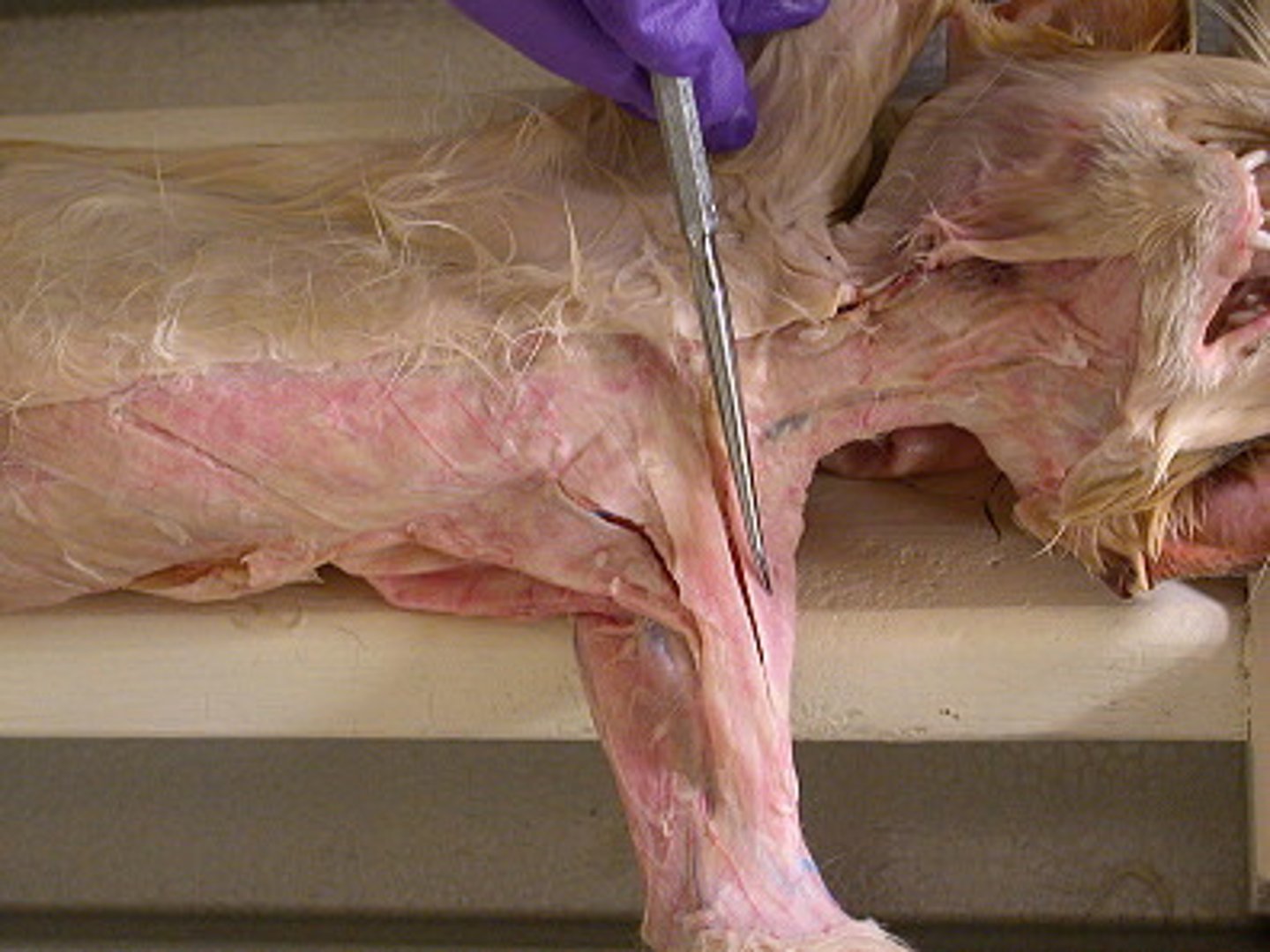 <p>name this muscle</p>