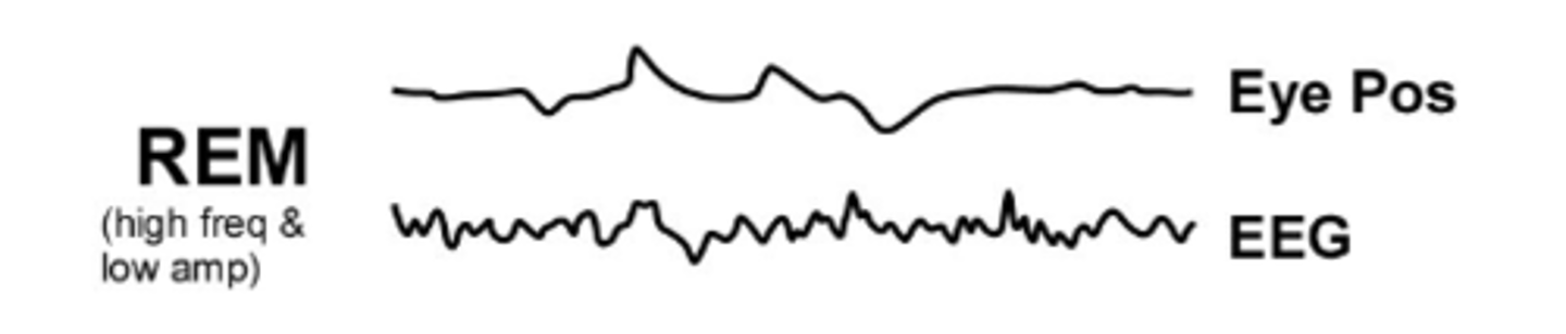 <p>describe REM sleep</p>