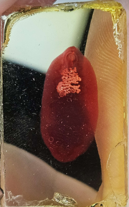 <p><span data-name="microscope" data-type="emoji">🔬</span><span data-name="petri_dish" data-type="emoji">🧫</span><strong><span> </span>Na podstawie zdjęcia preparatu:</strong></p><p></p><ul><li><p><span data-name="book" data-type="emoji">📖</span><span> </span>rozpoznaj gatunek pasożyta;</p></li></ul><p></p><ul><li><p><span data-name="recycle" data-type="emoji">♻</span><span> </span>rozpoznaj wszystkie formy rozwojowe;</p></li></ul><p></p><ul><li><p><span data-name="microbe" data-type="emoji">🦠</span><span> </span>wskaż organelle i cechy charakterystyczne dla danego gatunku;</p></li></ul><p></p><ul><li><p><span data-name="mask" data-type="emoji">😷</span><span> </span>nazwij chorobę, którą pasożyt wywołuje.</p></li></ul><p></p>