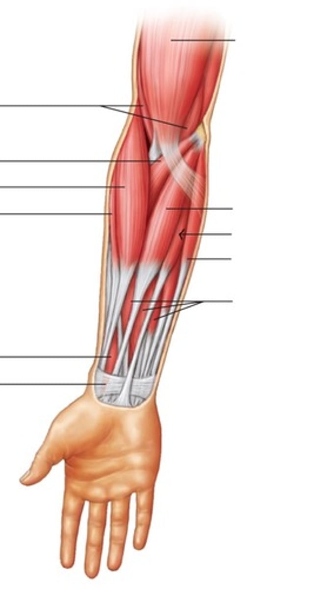 <p>What muscle is this?</p>