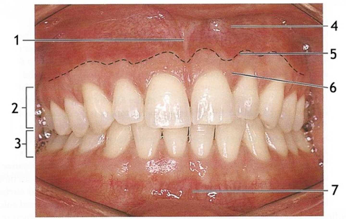 <p>identify parts of the oral mucosa</p>