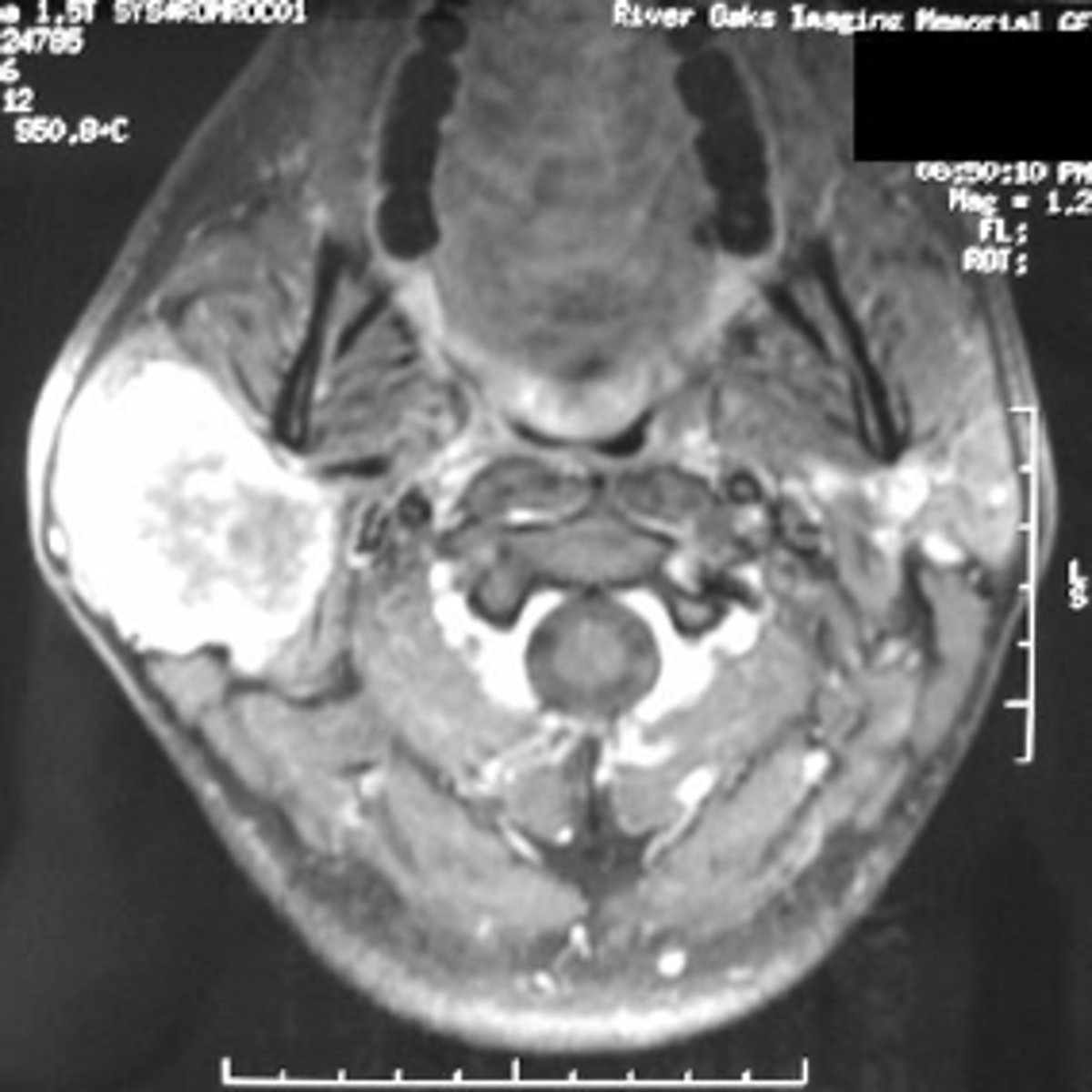 <p>ID the type of Imaging modality:</p><p>- Pano</p><p>- CT</p><p>- CBCT</p><p>- MRI</p><p>- Technetium 99 bone scans</p><p>- PET</p>