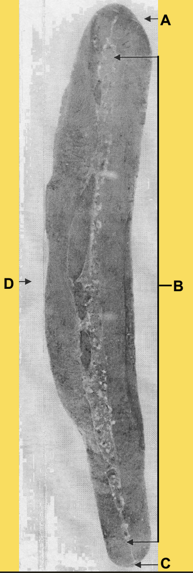 <p>D </p><p>(pig spleen, visceral surface)</p>