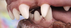 <p>Diastema</p>