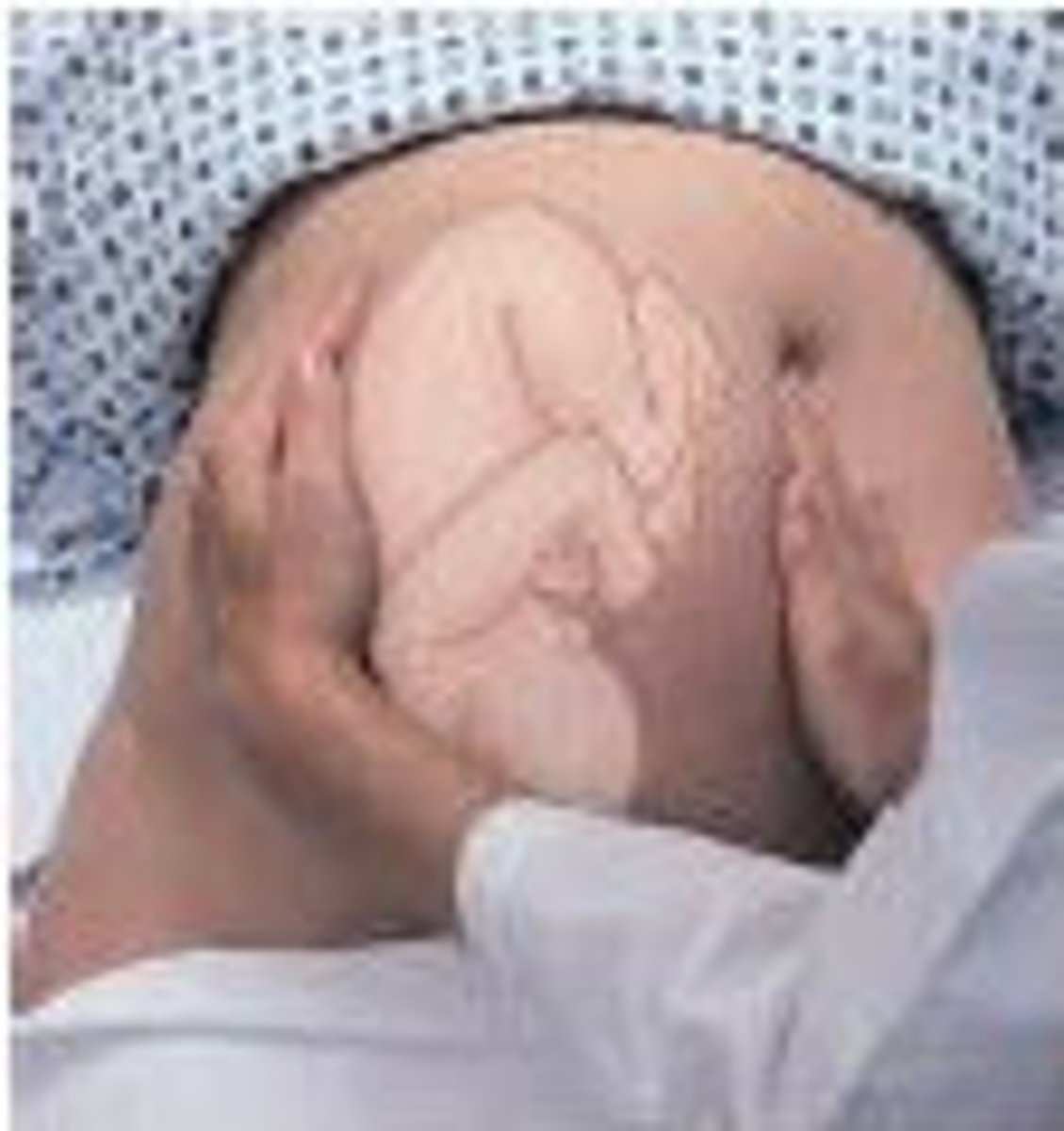 <p>palpation in the periumbilical regions with both hands by applying gentle but deep pressure</p>