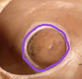 <p>What does this represent….</p>