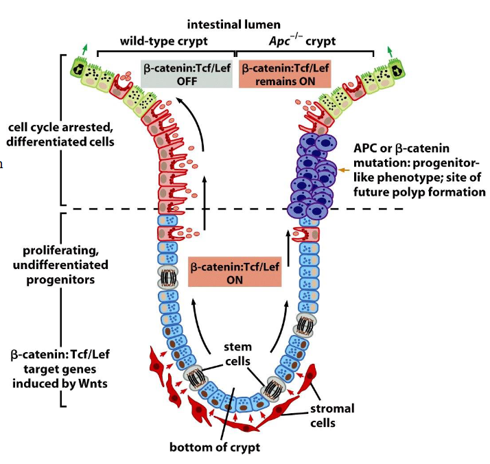 <p>β-catenin and the biology of colonic crypts in normal vs tumor cells</p>
