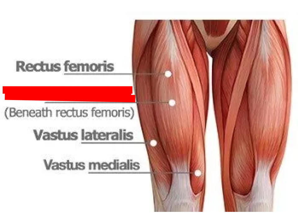 <p>Quadriceps</p>