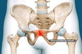 <p>Pubic Symphysis</p>