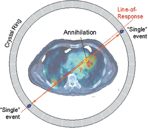 <p><span>How does a ‘dot’ from our image translate from the reaction at the PET detectors?</span></p>
