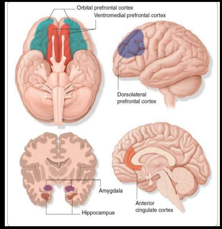 <p>decreased functioning of:</p><ul><li><p>orbital frontal cortex (OFC): related to reward functioning and how we respond to </p></li><li><p>ventral striatum: decision making functions and motor control</p></li><li><p>dorsolateral prefrontal cortex: cognitive control</p></li><li><p>Anterior cingulate cortex: selective attention</p></li><li><p>hippocampus (volume): learning and memory</p></li></ul><p>increased functioning of:</p><ul><li><p>amygdala: emotion and threat, fear</p></li></ul>